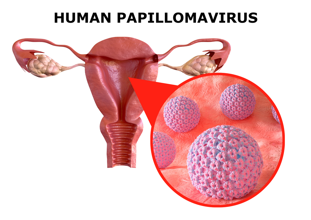 Clicca per accedere all'articolo “TUMORI FEMMINILI E L’HPV: E’ CAMBIATO QUALCOSA NEL  NUOVO MILLENNIO?”